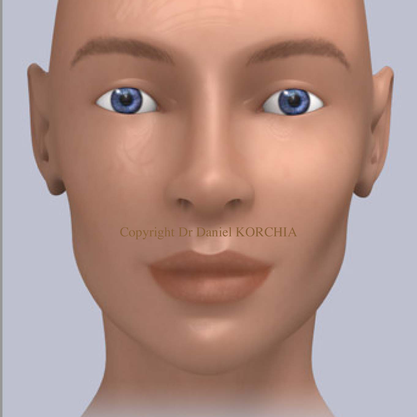 rhinoplastie nez large